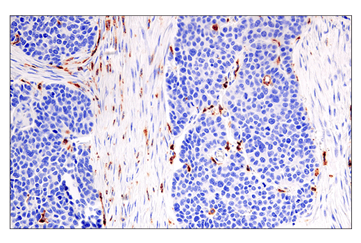 Immunohistochemistry Image 2: HLA-DRA (E9R2Q) XP<sup>®</sup> Rabbit mAb (BSA and Azide Free)