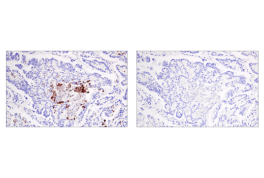 Immunohistochemistry Image 2: Cleaved Gasdermin D (Asp275) (E7H9G) Rabbit Monoclonal Antibody (BSA and Azide Free)