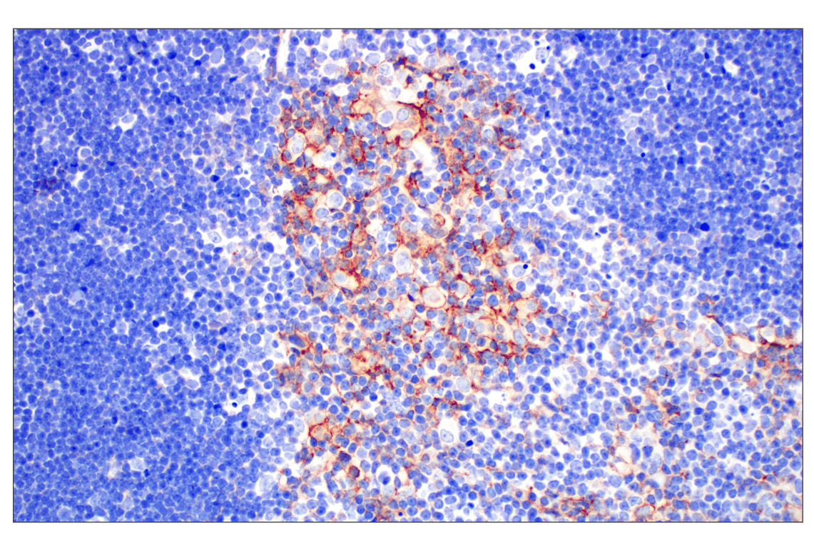 Immunohistochemistry Image 9: EpCAM (D9S3P) Rabbit mAb