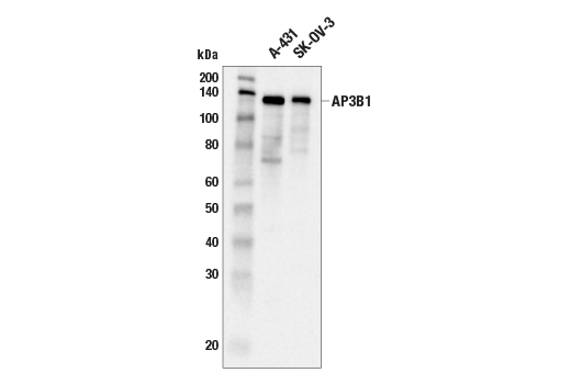 Western Blotting Image 1: AP3B1 (E7U2P) Rabbit mAb