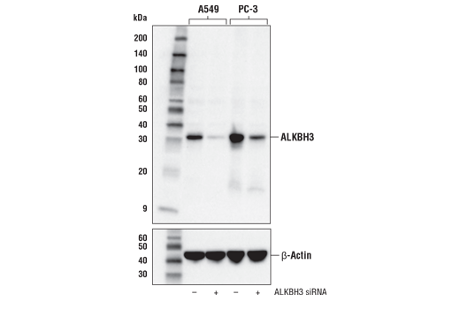 Western Blotting Image 1: ALKBH3 (E6S4R) Rabbit mAb