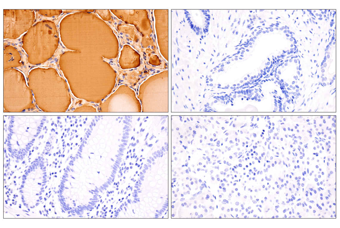 Immunohistochemistry Image 2: Thyroglobulin (F5O9B) Rabbit Monoclonal Antibody