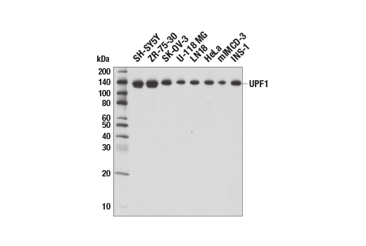 Western Blotting Image 1: UPF1 (D15G6) Rabbit mAb