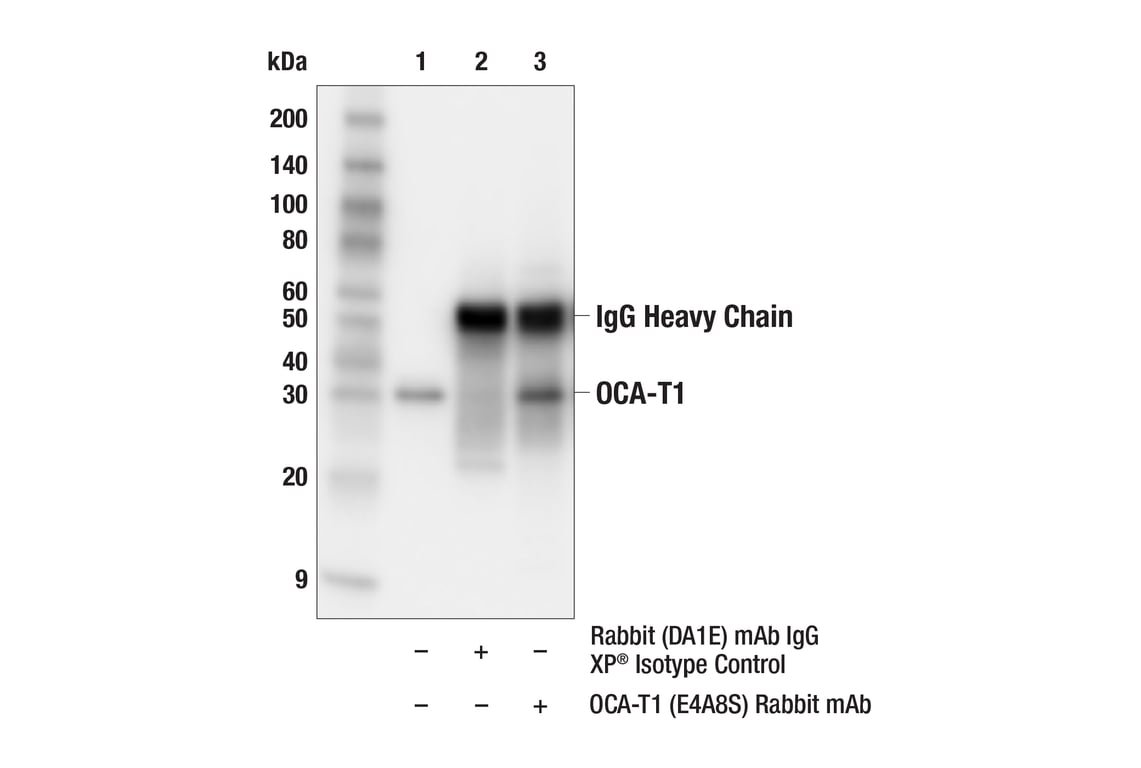 Immunoprecipitation Image 1: OCA-T1 (E4A8S) Rabbit Monoclonal Antibody