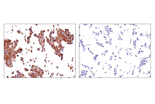 BCAT2 (D8K3O) Rabbit mAb | Cell Signaling Technology