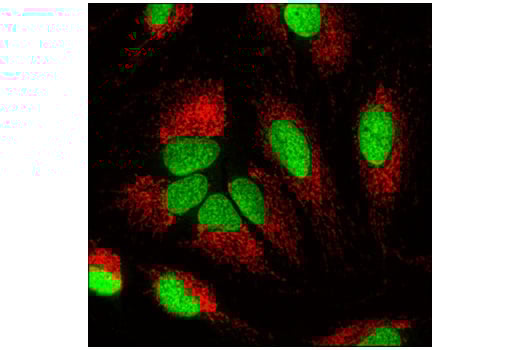 Immunofluorescence Image 1: Ubiquityl-Histone H2B (Lys120) (D11) Rabbit Monoclonal Antibody (BSA and Azide Free)