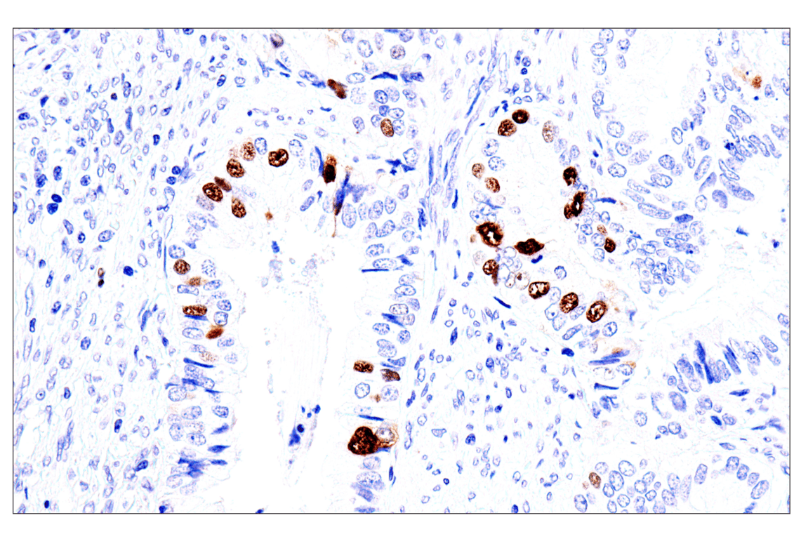 Immunohistochemistry Image 2: Phospho-NPM1 (Thr199) (E4C7S) Rabbit Monoclonal Antibody (BSA and Azide Free)