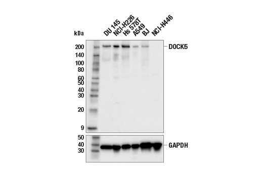 Western Blotting Image 1: DOCK5 (E6R9W) Rabbit mAb