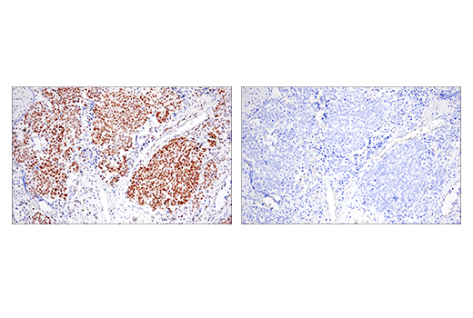 Immunohistochemistry Image 7: EED (E4L6E) Rabbit Monoclonal Antibody