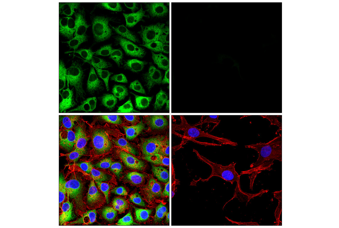 Immunofluorescence Image 1: POR (F6Y3C) Rabbit Monoclonal Antibody