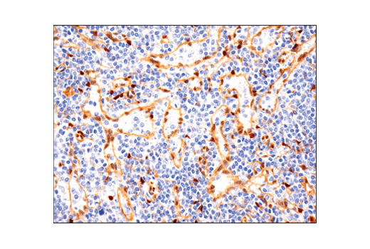 Immunohistochemistry Image 1: YAP (D8H1X) Rabbit Monoclonal Antibody (BSA and Azide Free)