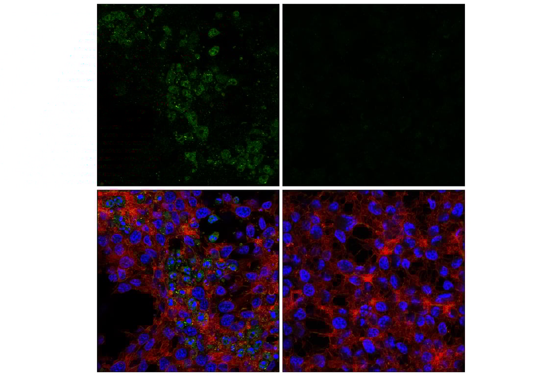 Immunofluorescence Image 1: Cleaved Caspase-8 (Asp374) (E6H8S) Rabbit Monoclonal Antibody
