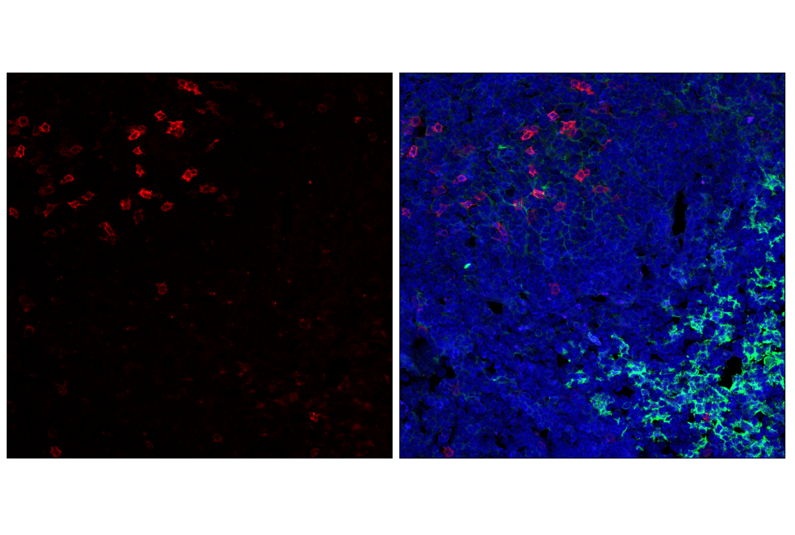 Immunofluorescence Image 2: PD-1 (Intracellular Domain) (D7D5W) Rabbit Monoclonal Antibody (Alexa Fluor<sup>®</sup> 647 Conjugate)