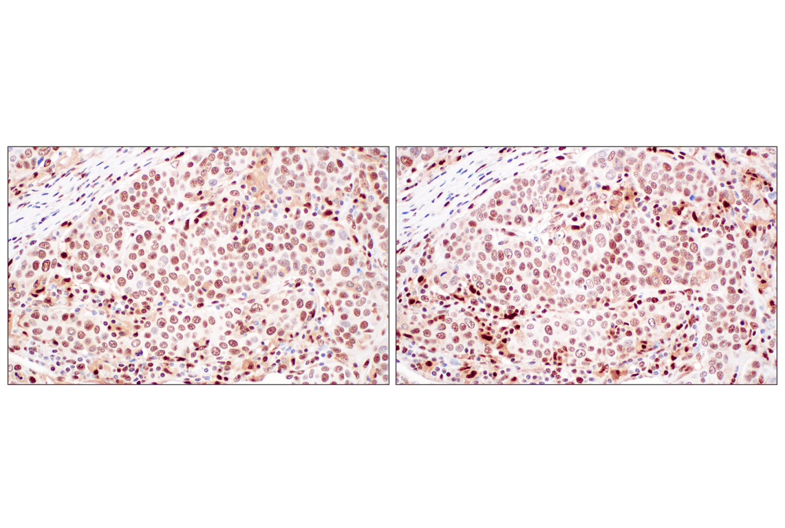 Immunohistochemistry Image 15: FKBP5 (F1G3I) Rabbit Monoclonal Antibody