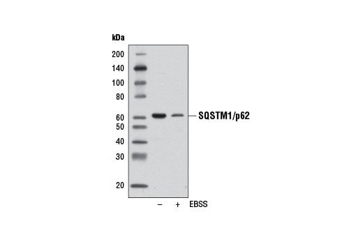 undefined Image 25: Mitophagy Antibody Sampler Kit