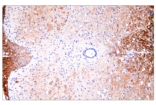 Immunohistochemistry Image 4: Neurofilament-H (E7Z7G) Rabbit Monoclonal Antibody (BSA and Azide Free)