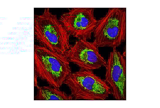 Immunofluorescence Image 1: ORC2 (3G6) Rat Monoclonal Antibody