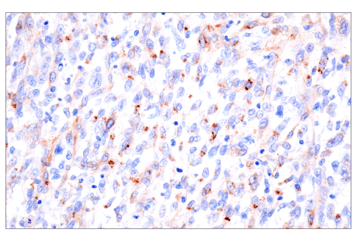 Immunohistochemistry Image 3: FAP (F1A4G) Rabbit Monoclonal Antibody (BSA and Azide Free)