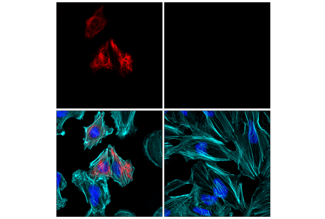 Immunofluorescence Image 1: GFAP (E4L7M) Rabbit Monoclonal Antibody (Alexa Fluor<sup>®</sup> 555 Conjugate)