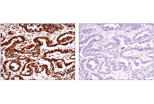 Immunohistochemistry Image 4: Tri-Methyl-Histone H3 (Lys36) (D5A7) Rabbit Monoclonal Antibody (BSA and Azide Free)