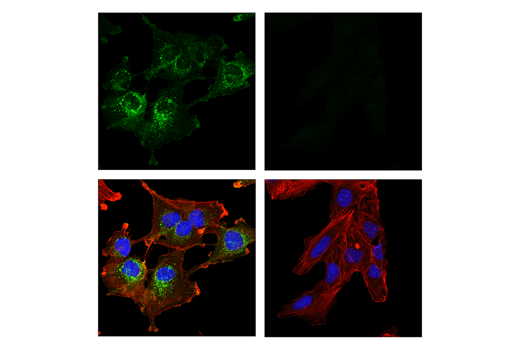 Immunofluorescence Image 1: CD10/Neprilysin (E5P7S) Rabbit Monoclonal Antibody