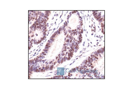 Immunohistochemistry Image 2: Phospho-(Ser/Thr) Akt Substrate Antibody