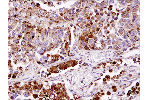 Immunohistochemistry Image 2: LAMP1 (D2D11) Rabbit Monoclonal Antibody (BSA and Azide Free)