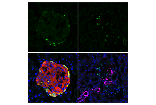 Immunofluorescence Image 1: MAFB (E3O9X) Rabbit Monoclonal Antibody