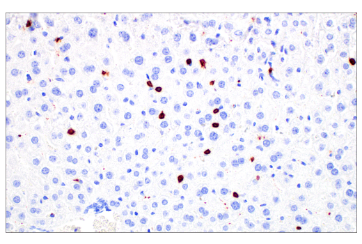 Immunohistochemistry Image 2: CD20 (E3N7O) Rabbit Monoclonal Antibody (BSA and Azide Free)