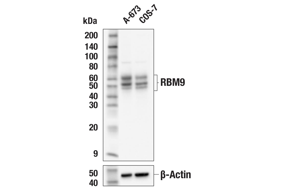 Western Blotting Image 2: RBM9 (E7W6U) Rabbit Monoclonal Antibody