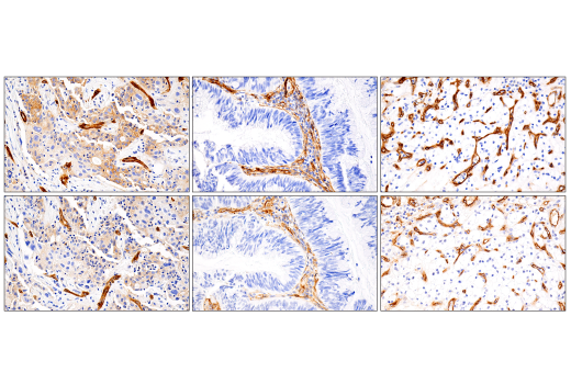 Immunohistochemistry Image 5: MCAM (E3F3E) Rabbit Monoclonal Antibody (BSA and Azide Free)