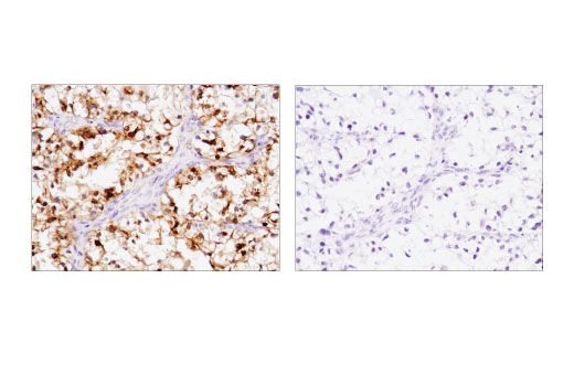Immunohistochemistry Image 3: IGFBP1 (D4E9T) Rabbit Monoclonal Antibody (BSA and Azide Free)