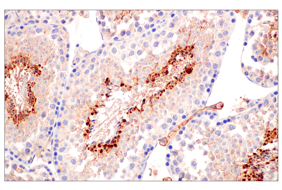 Immunohistochemistry Image 4: CD10/Neprilysin (F4P6H) Rabbit Monoclonal Antibody (BSA and Azide Free)