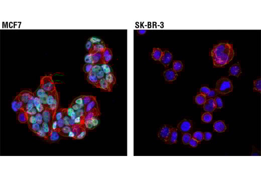 Immunofluorescence Image 1: Estrogen Receptor alpha (D6R2W) Rabbit Monoclonal Antibody