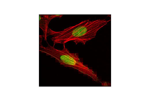 Immunofluorescence Image 1: ASF1A (C6E10) Rabbit Monoclonal Antibody