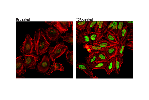 Immunofluorescence Image 1: Acetyl-Histone H3 (Lys36) (D9T5Q) Rabbit mAb (Alexa Fluor<sup>®</sup> 488 Conjugate)