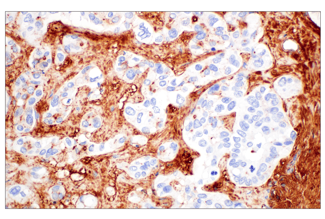 Immunohistochemistry Image 2: Hyaluronan Complete Tissue Staining Kit (HRP)