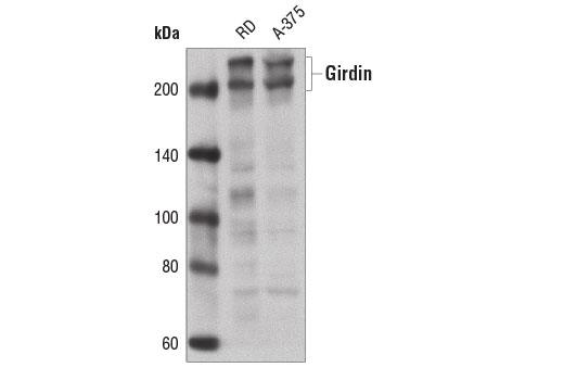 Western Blotting Image 1: Girdin Antibody