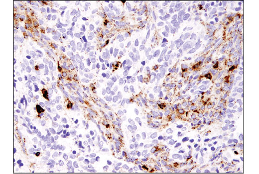Immunohistochemistry Image 3: Cathepsin B (D1C7Y) Rabbit Monoclonal Antibody