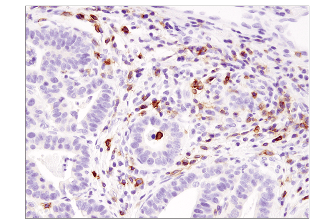 Immunohistochemistry Image 2: ICOS (D1K2T<sup>™</sup>) Rabbit mAb