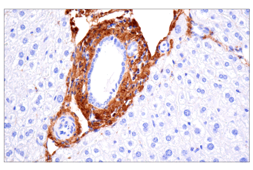 Immunohistochemistry Image 6: COL1A1 (E8F4L) Rabbit Monoclonal Antibody (BSA and Azide Free)