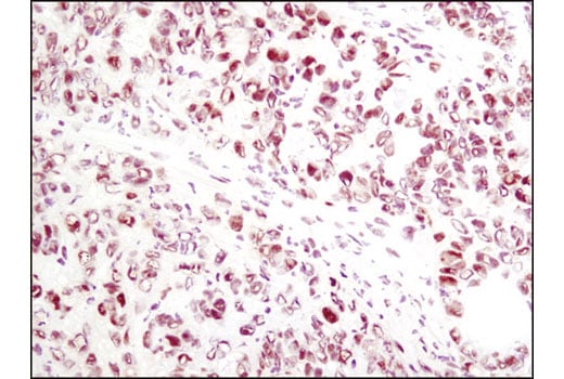 undefined Image 23: CDK Antibody Sampler Kit