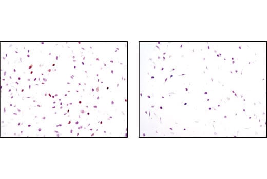 Immunohistochemistry Image 2: p21 Waf1/Cip1 (12D1) Rabbit Monoclonal Antibody