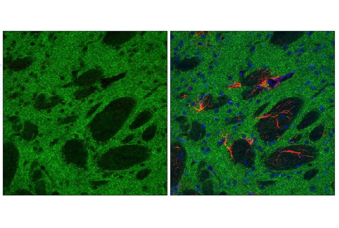 Immunofluorescence Image 2: TOM70 (E7E1M) Rabbit Monoclonal Antibody