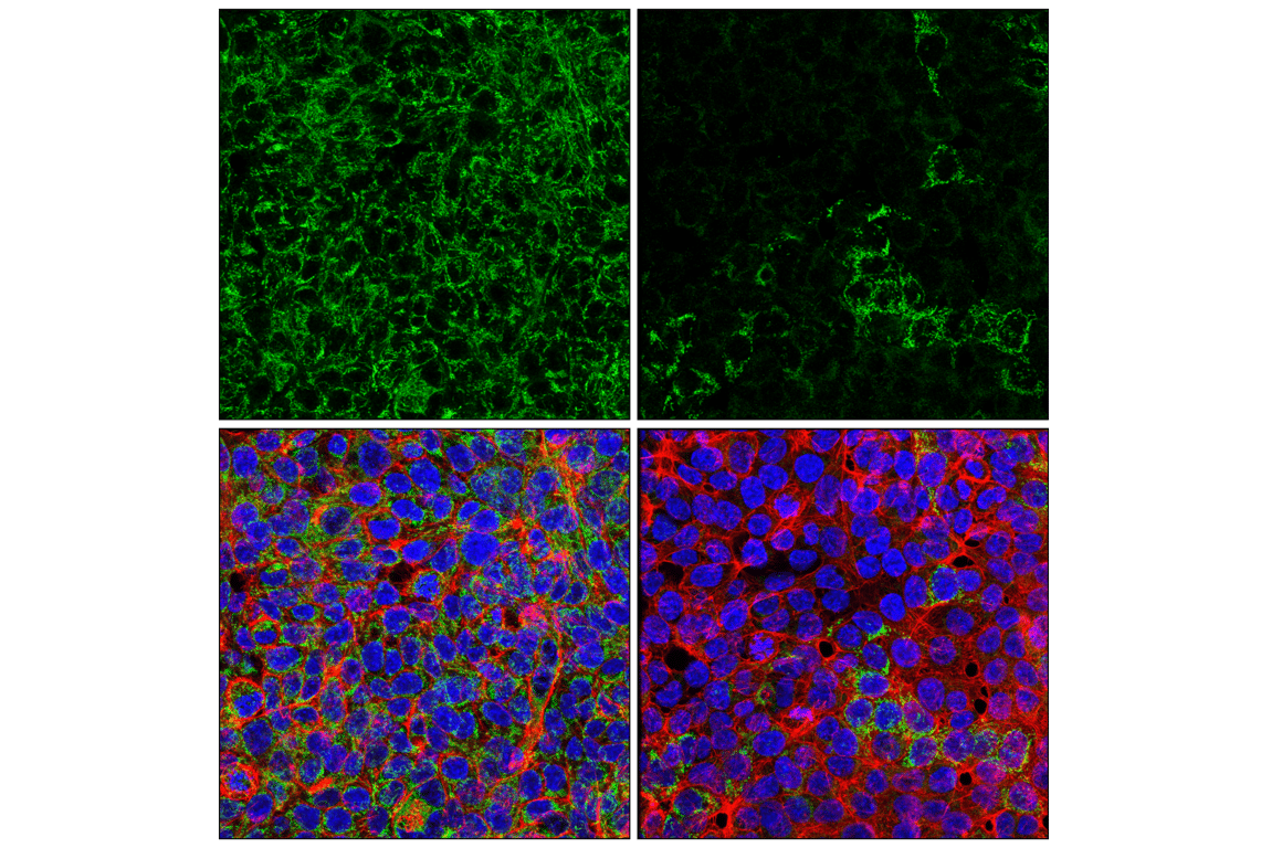 Immunofluorescence Image 1: SLC25A1 (E7B2B) Rabbit Monoclonal Antibody