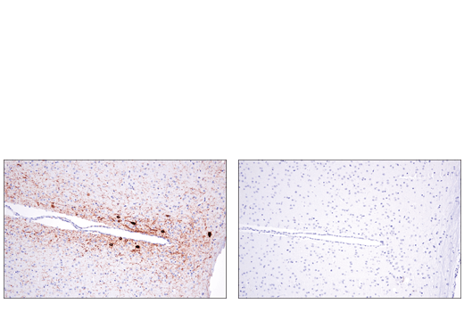 Immunohistochemistry Image 1: Tyrosine Hydroxylase (E2L6M) Rabbit Monoclonal Antibody
