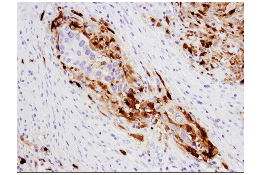 Immunohistochemistry Image 5: S100A9 (D5O6O) Rabbit Monoclonal Antibody (IHC Formulated)
