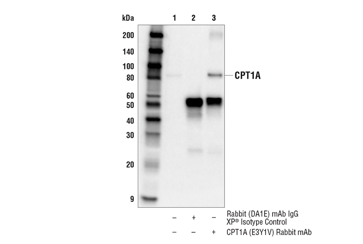 Immunoprecipitation Image 1: CPT1A (E3Y1V) Rabbit Monoclonal Antibody
