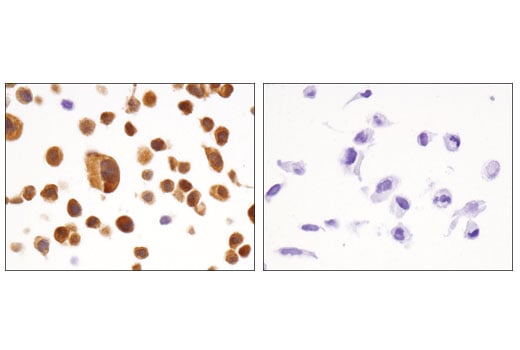 Immunohistochemistry Image 2: FABP5 (D1A7T) Rabbit Monoclonal Antibody (BSA and Azide Free)