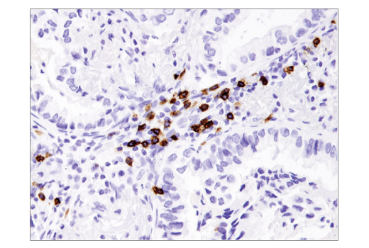 Immunohistochemistry Image 2: CD8 alpha (D8A8Y) Rabbit Monoclonal Antibody (BSA and Azide Free)